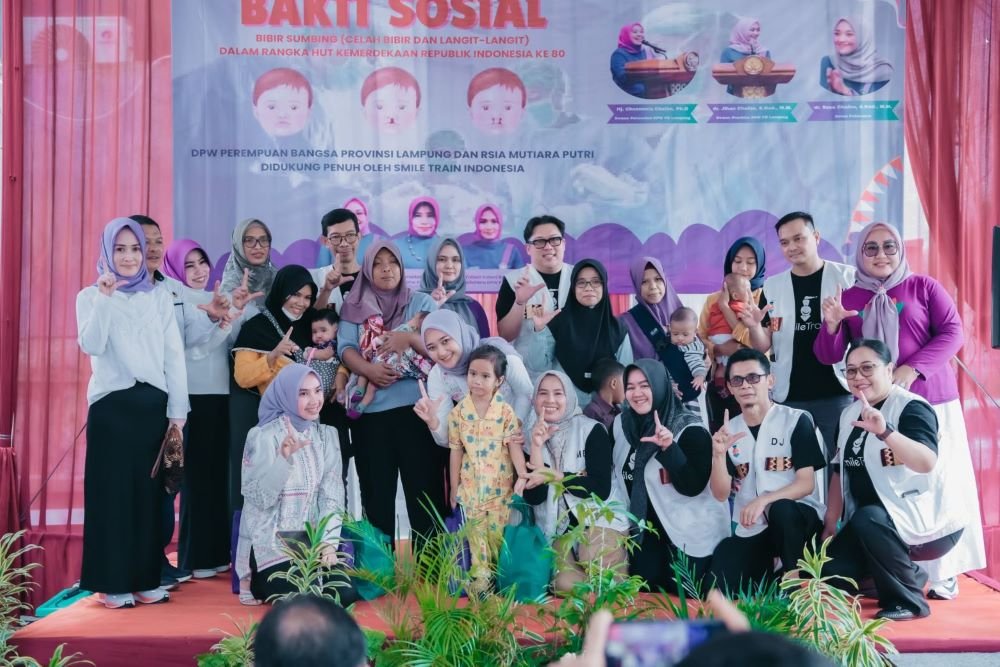 Bakti Sosial Operasi Bibir Sumbing Gratis yang Diselenggarakan Perempuan Bangsa Bekerja Sama dengan Smile Train dan RS Mutiara Putri Dapatkan Apresiasi Dari Wagub Jihan